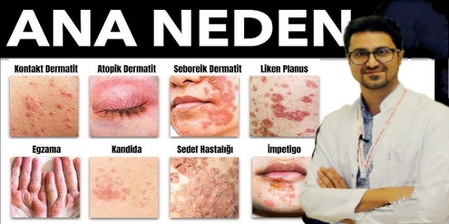 DİKKAT UZMAN ANA NEDENLERİNİ AÇIKLADI 