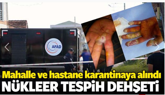 Nükleer tespih hayatını kararttı!