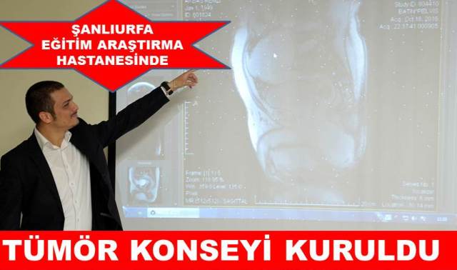 TÜMÖR KONSEYİ KURULDU